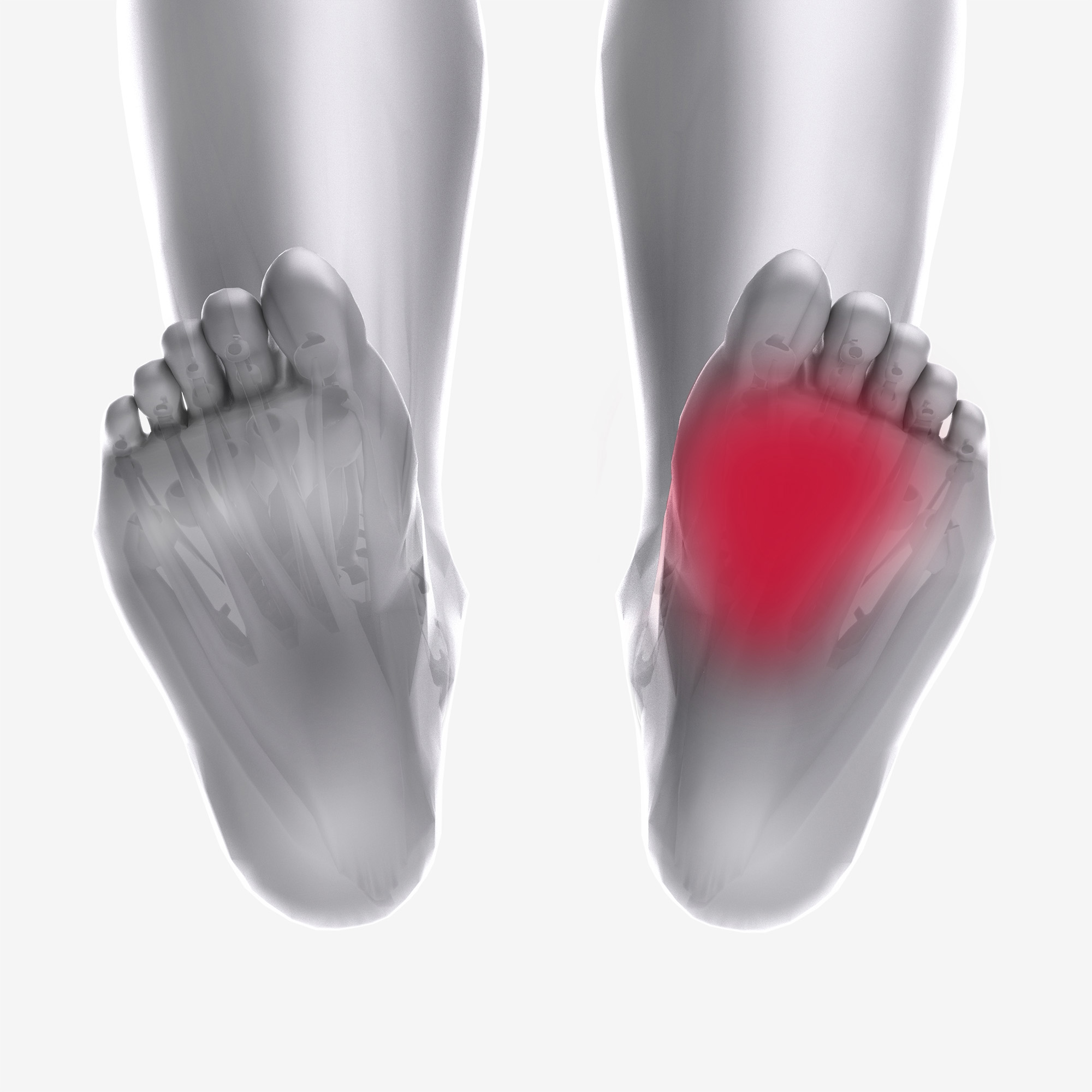 Adductor Hallucis