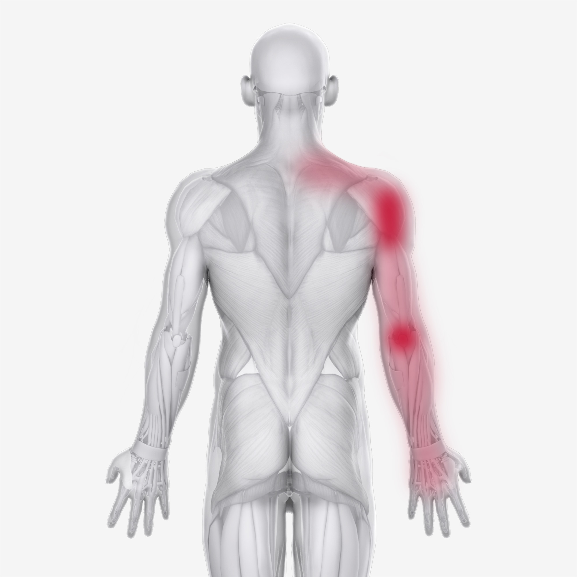 Supraspinatus