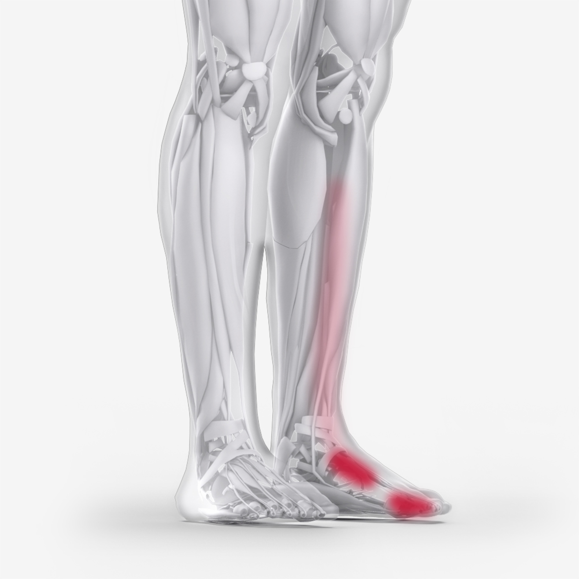 Tibialis Anterior